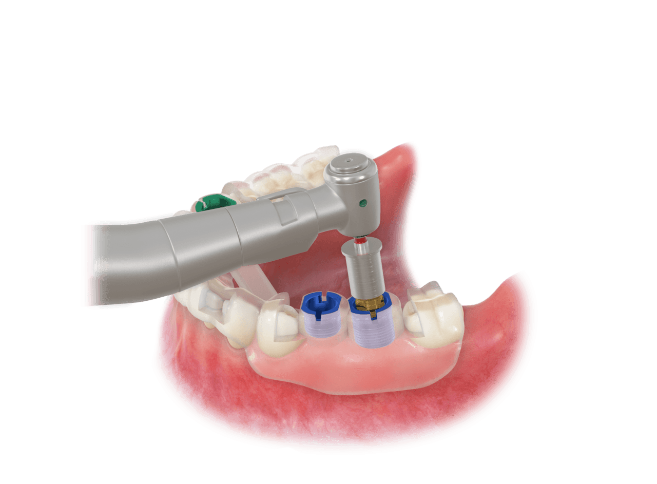 SPlant Dental Hospital 2